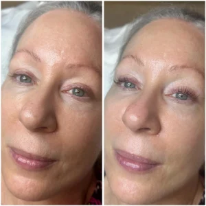 Lash Lift