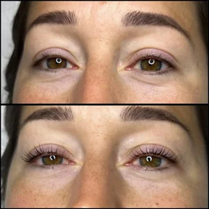 Lash Lift