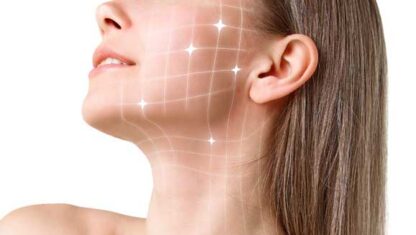 visia skin analysis tretament